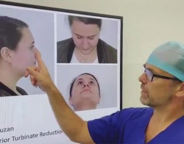 best nose surgery sydney - best nose surgeon sydney