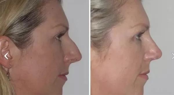 Roman - Dr Jeremy Hunt Leading face surgeon